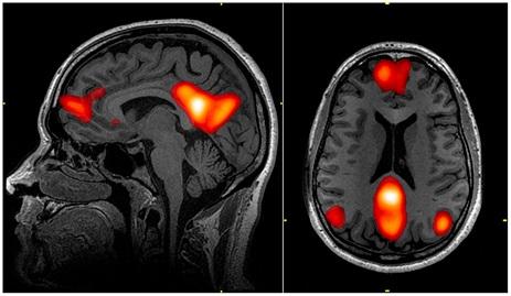 Images of MRI scans
